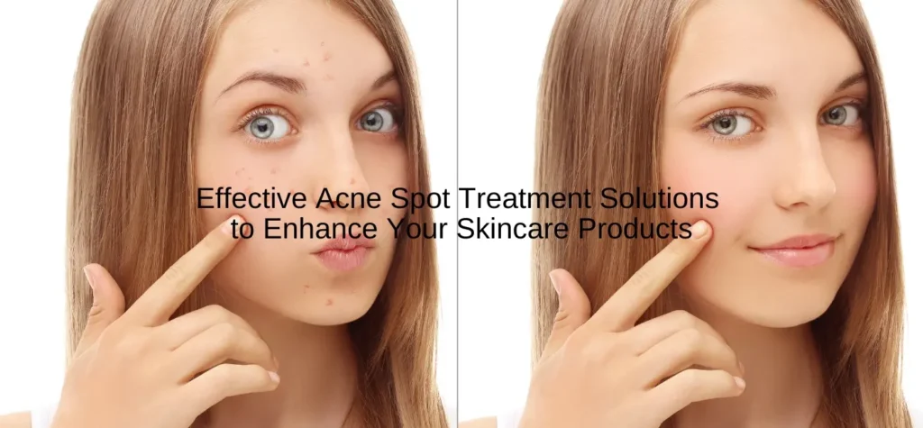 effective acne spot treatment solutions to enhance your skincare products